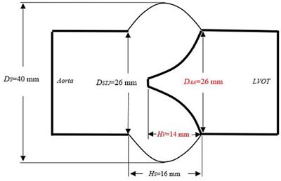 Effect of Valve Height on the Opening and Closing Performance of the Aortic Valve Under Aortic Root Dilatation